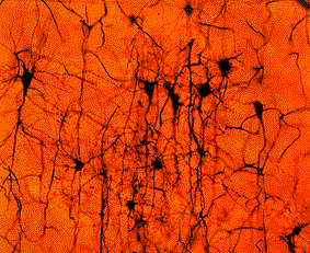 C�lulas nerviosas de la corteza cerebral