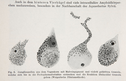 Gonzalo Rodr&iacute;guez Lafora, &laquo;Beitrag zur Histopatologie der myclonischen Epilepsie&raquo;, Zeitschrift f&uuml;r die Gesamte Neurologie und Psychiatrie, Berl&iacute;n, vol. 6, fasc. 1, 1919
